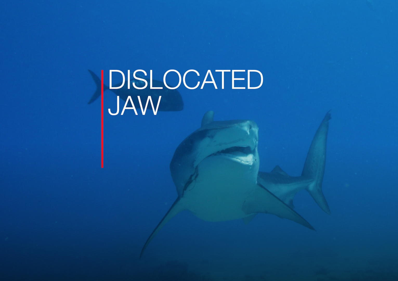 Tiger Shark with a Dislocated Jaw